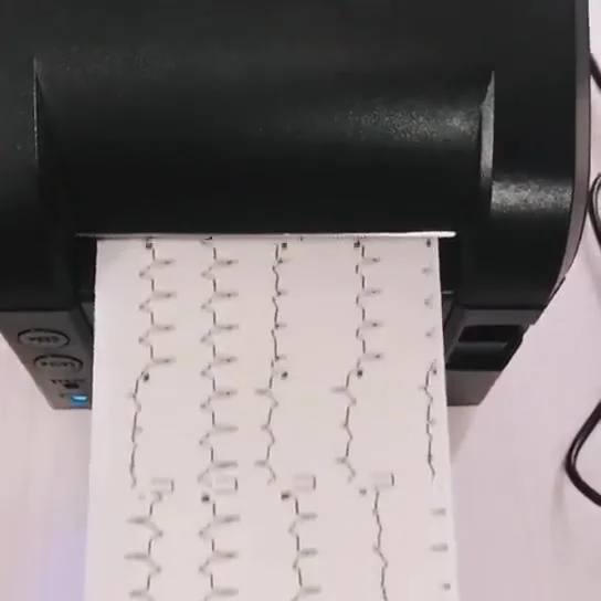 Бумага для термопринтера электрокардиографа 50 мм * 20 м/80 20/110 м CONTEC ECG100G ECG90A ECG600G