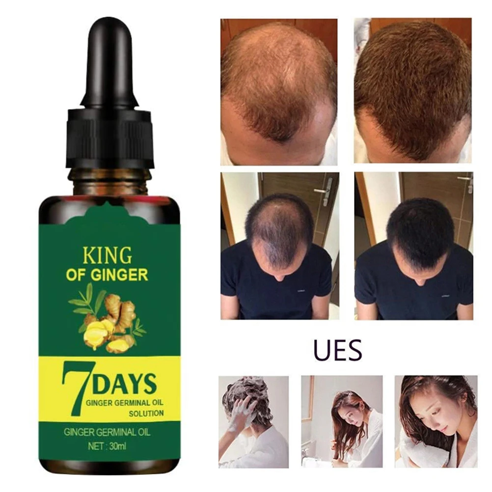 30ml Ginger Hair Growth Serum Refreshing Oil Control Stop Hair Loss Hair Care For men and Women