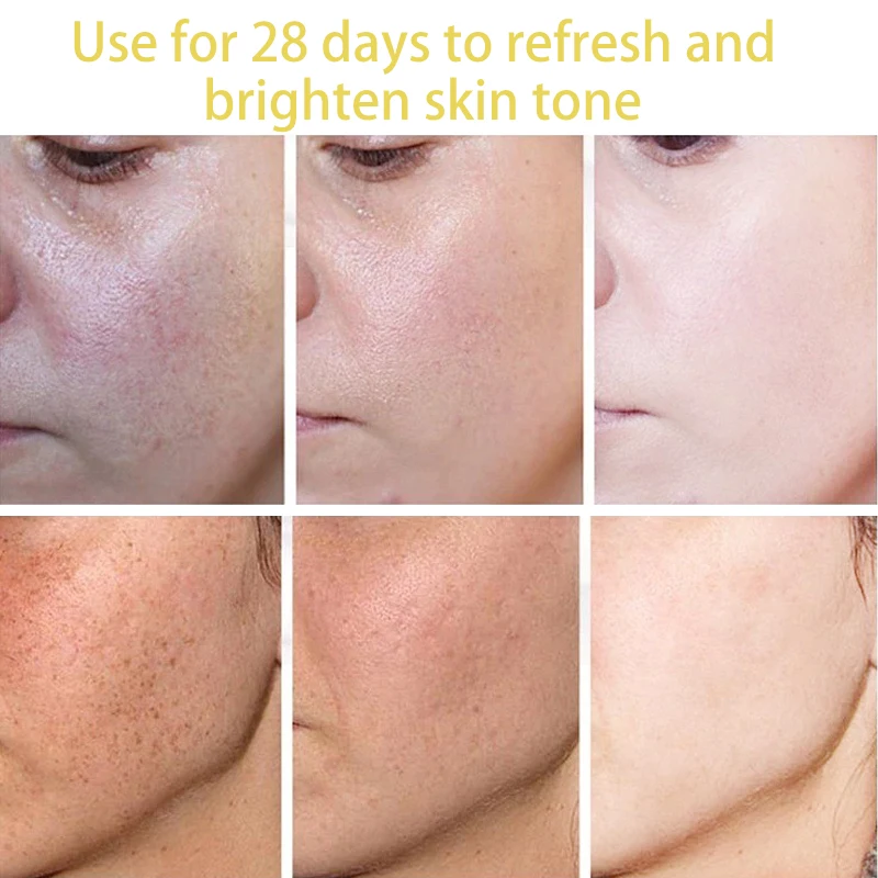 Siero viso sbiancante per lentiggini alla vitamina C Rimuovi le macchie scure Dissolvenza Melasma Anti-età Illumina Tonico idratante all'essenza_voghion.com