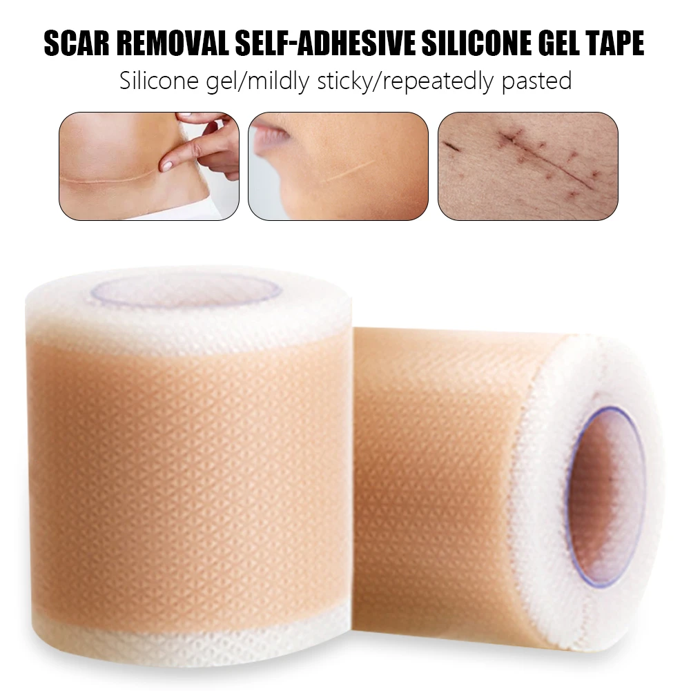 Efficient Surgery Self Adhesive Silicone Gel Tape Removal Scar Tape