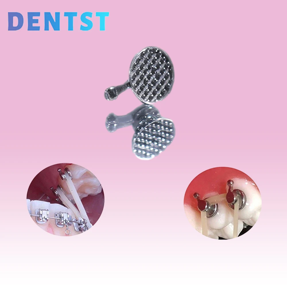 круглые ортодонтические скобы