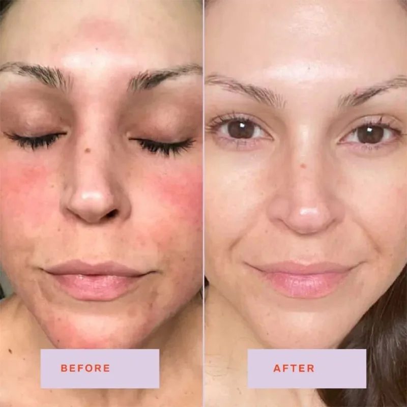 Face Toner Moisturizing Water Brightening Lifting Moisturizing Soothe Deep Facial Cleanser Glowy Korean Skin Care For All Skin