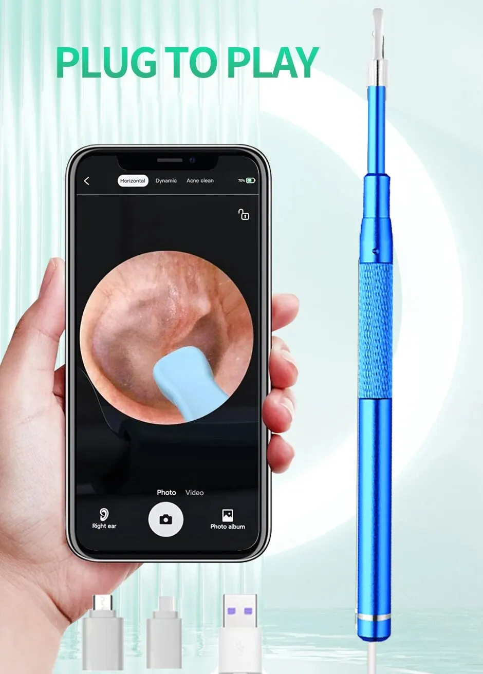 5.5MM, HD, Visual Ear Endoscope 3 in 1 USB Otoscope Ear Wax Removal HD Endoscope Mini Camera Otoscope Health Care For PC Android Mallzona