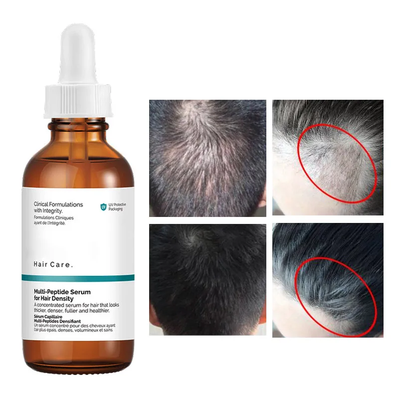 Buy Intimify Hair Serum for Hair Fall, Hair Roots, Density, Thickness and  Dryness Online at Best Prices in India - JioMart.