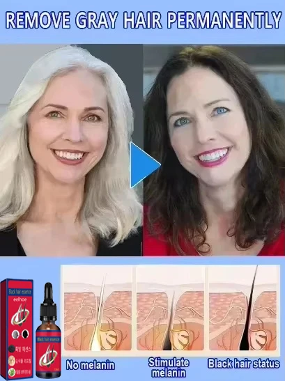 White hair killer remove gray hair restore natural color 7 days hair coloring product