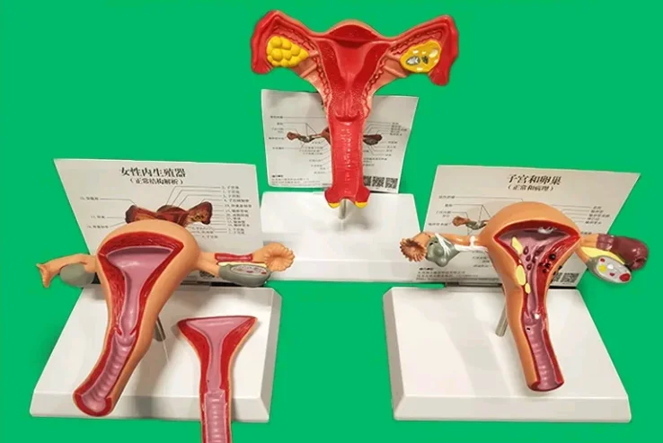 

Human Ovary and uterus disease Dissection model Pathology Female uterus model teaching medical aids anatomy lesion uterus