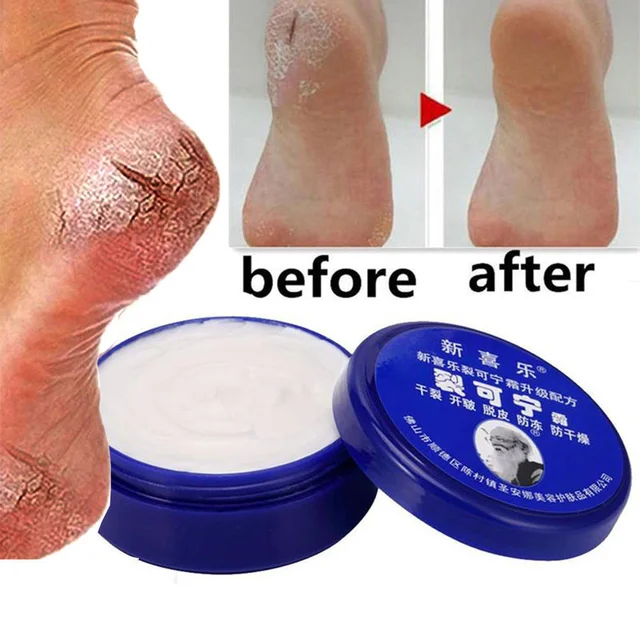 Instant Anti Crack Foot Cream Herbal AntiDrying Crack Foot Oil Heel Cracked Repair Cream