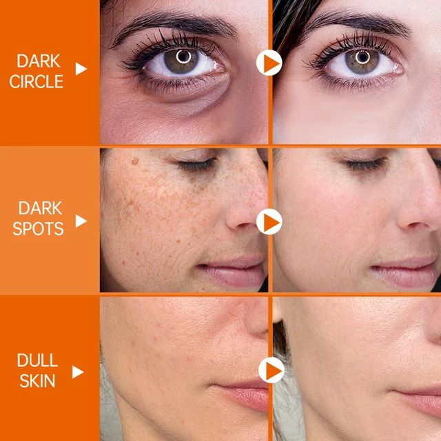 JoyPretty – ensemble de soins pour la peau, crème blanchissante, nettoyant, brillant, hydratant, pour la peau foncée, sérum, produits pour le visage, 5 pièces