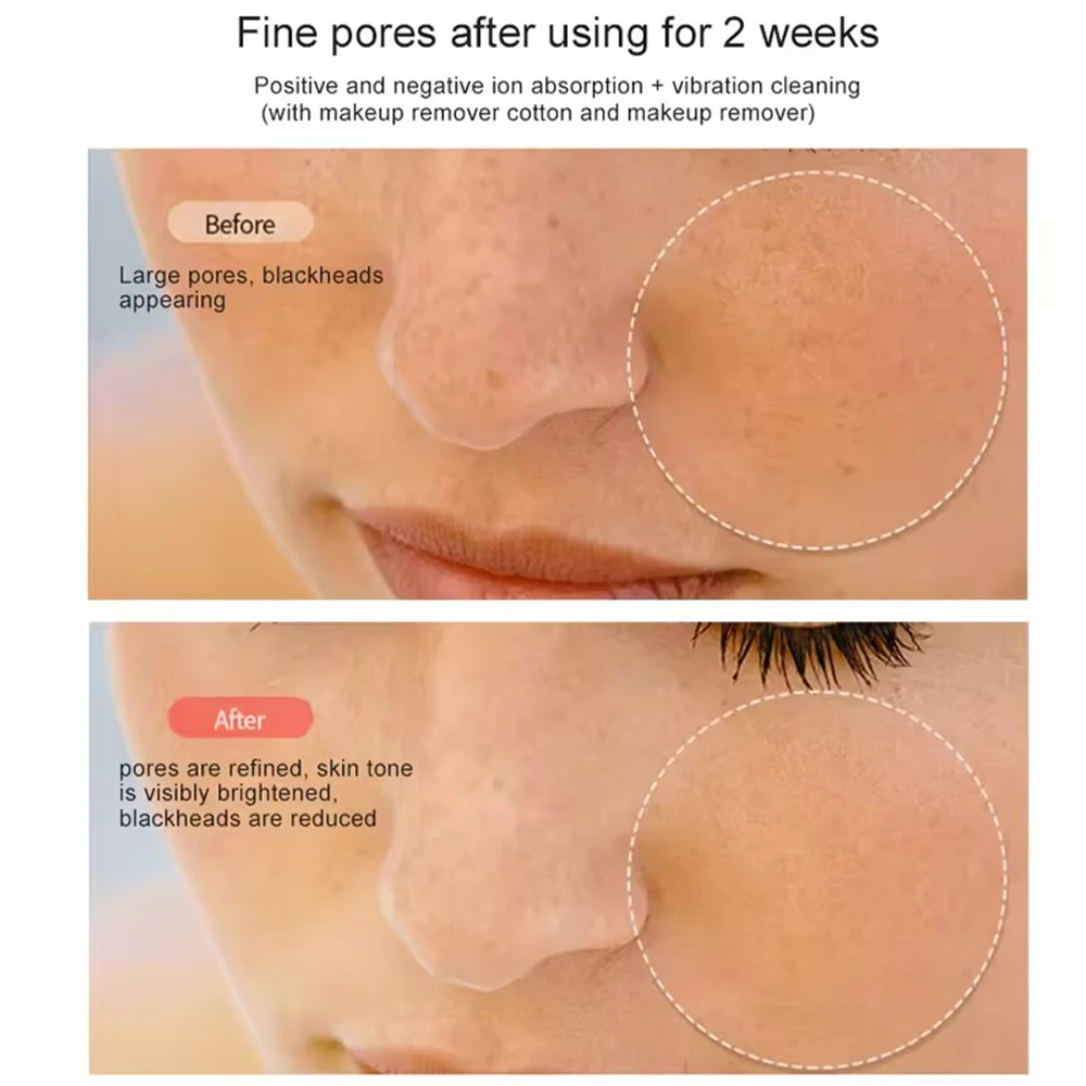 HIFU Face Skin Care EMS Facial Lifting Massager LED Photon Wrinkle Remover RF Beauty Device 1200Hz Vibration Anti-aging Device