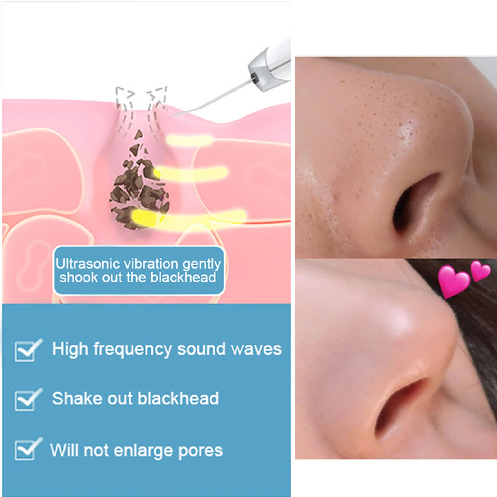 Skin Scrubber Deep Vibrate Facial Cleaner Shovel Spatula Not Ultrasonic Face Scrubber Pore Cleaner Facial Shovel Massage