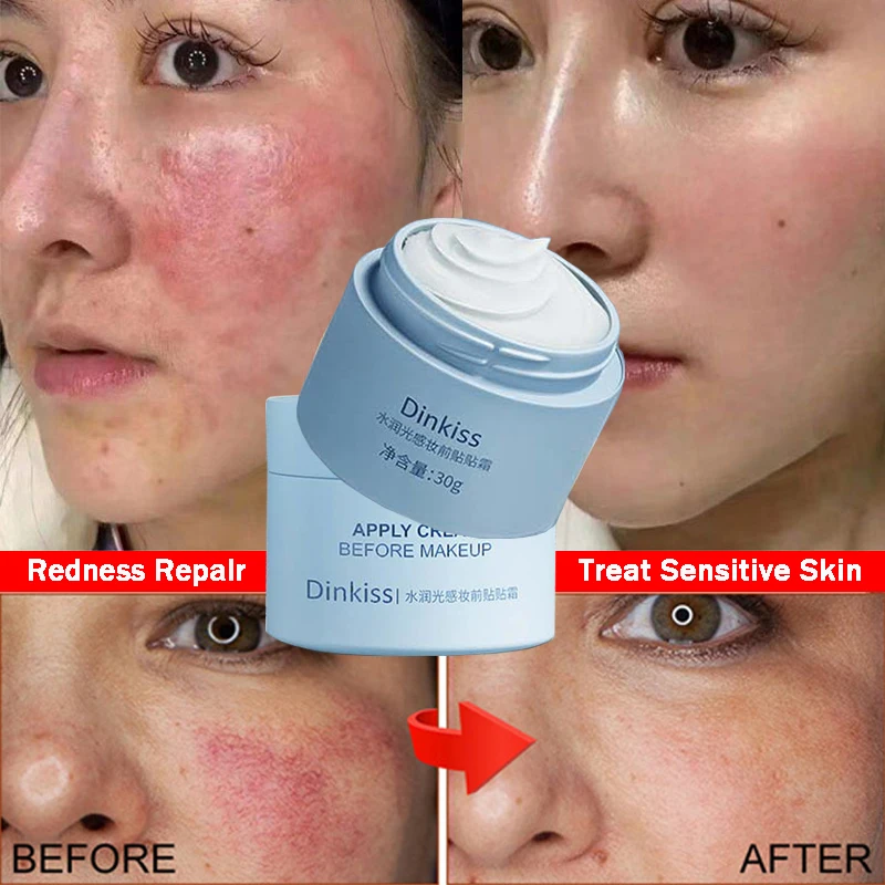 

Effective Facial Redness Repair Cream Rosacea Treat Sensitive Skin Dryness Moisturizer Hydrating Sooth Lotion Korean Cosmetics