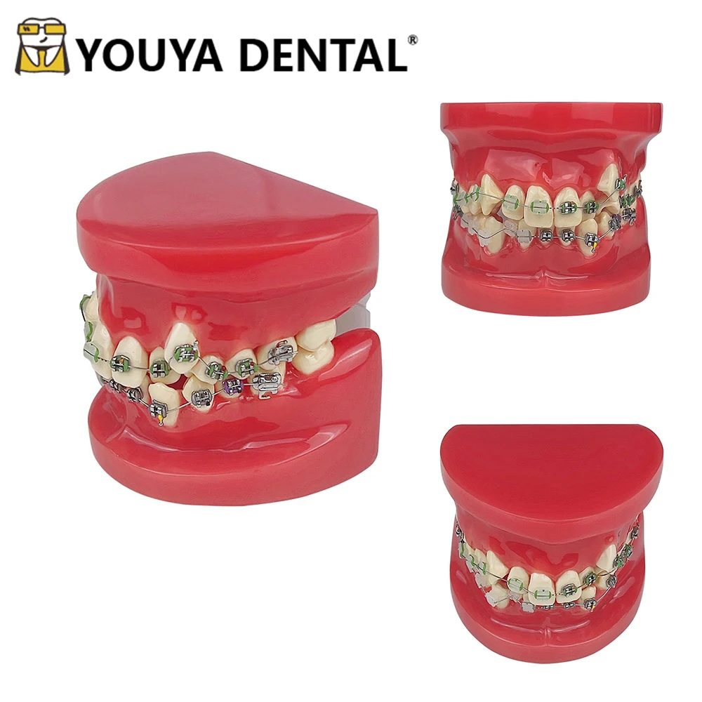 

Orthodontic Teaching Model Half Metal Half Ceramic Bracket for Dentist Student Practice Studying Doctor-patient Communication