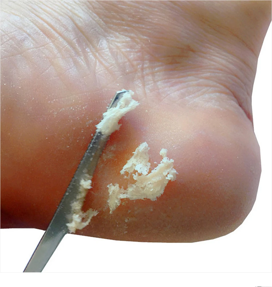 1Pcs Foot Scraper Toe Nail Feet Pedicure Knife Dead Skin Remover Stainless Steel Heel Scraper File Manicure Pedicure Tools