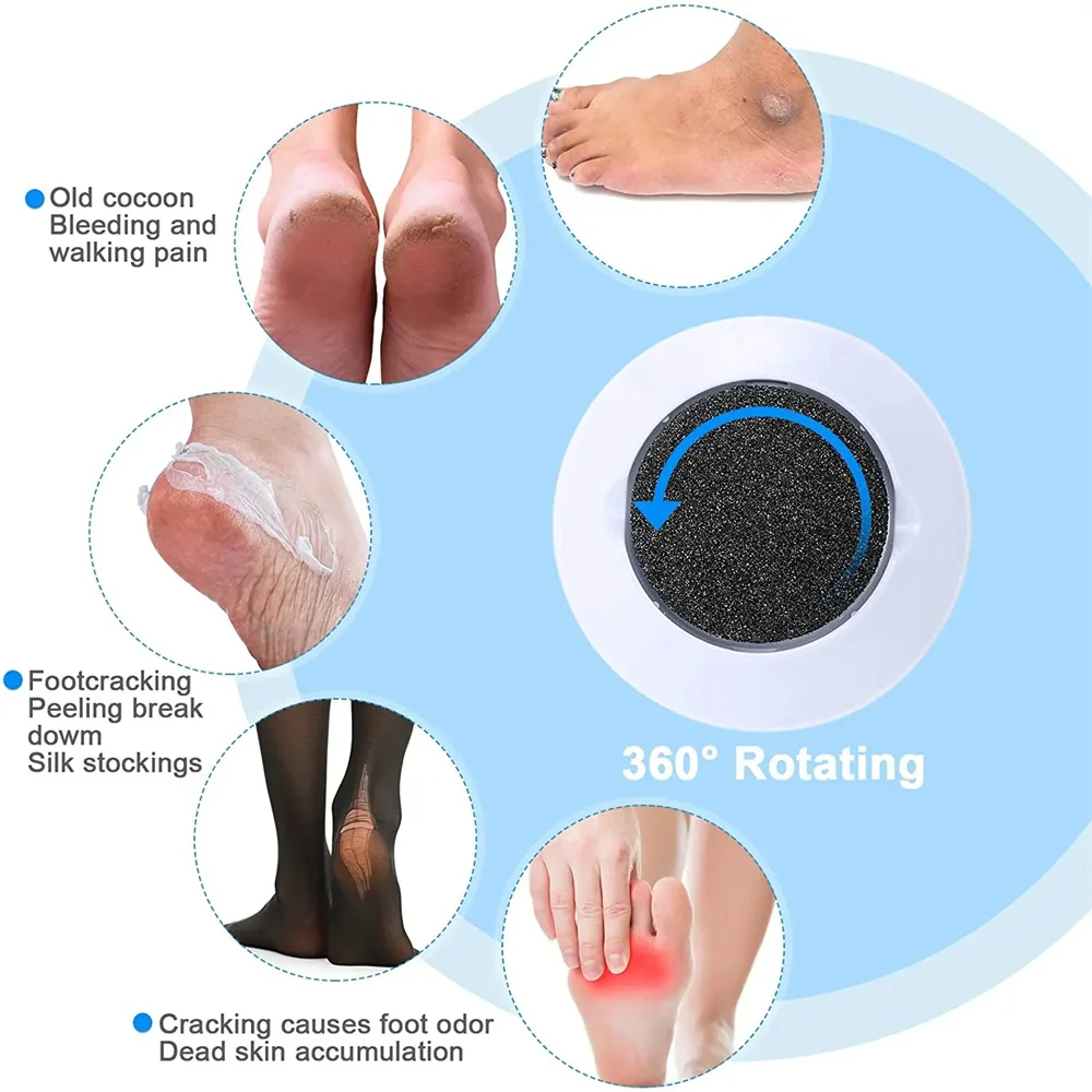 10Pcs Dull Polish Foot care tool Heads Hard Skin Remover Refills Replacement Rollers For Scholls File Feet care Tool Foot File Foot Care Tool
