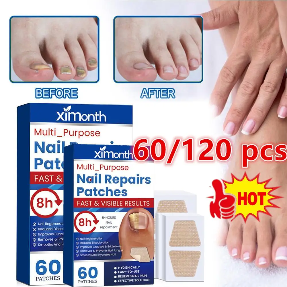 Anti Infection Nail Patch Onychomycosis Removal Grey Nail Repair Remove Fungus Ingrown Toenail Care Paronychia Treatment Sticker