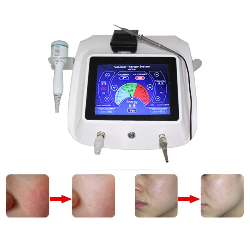 

980 high-frequency red blood streak removal instrument RF repair and improve redness beauty salon silk cleaning instrument