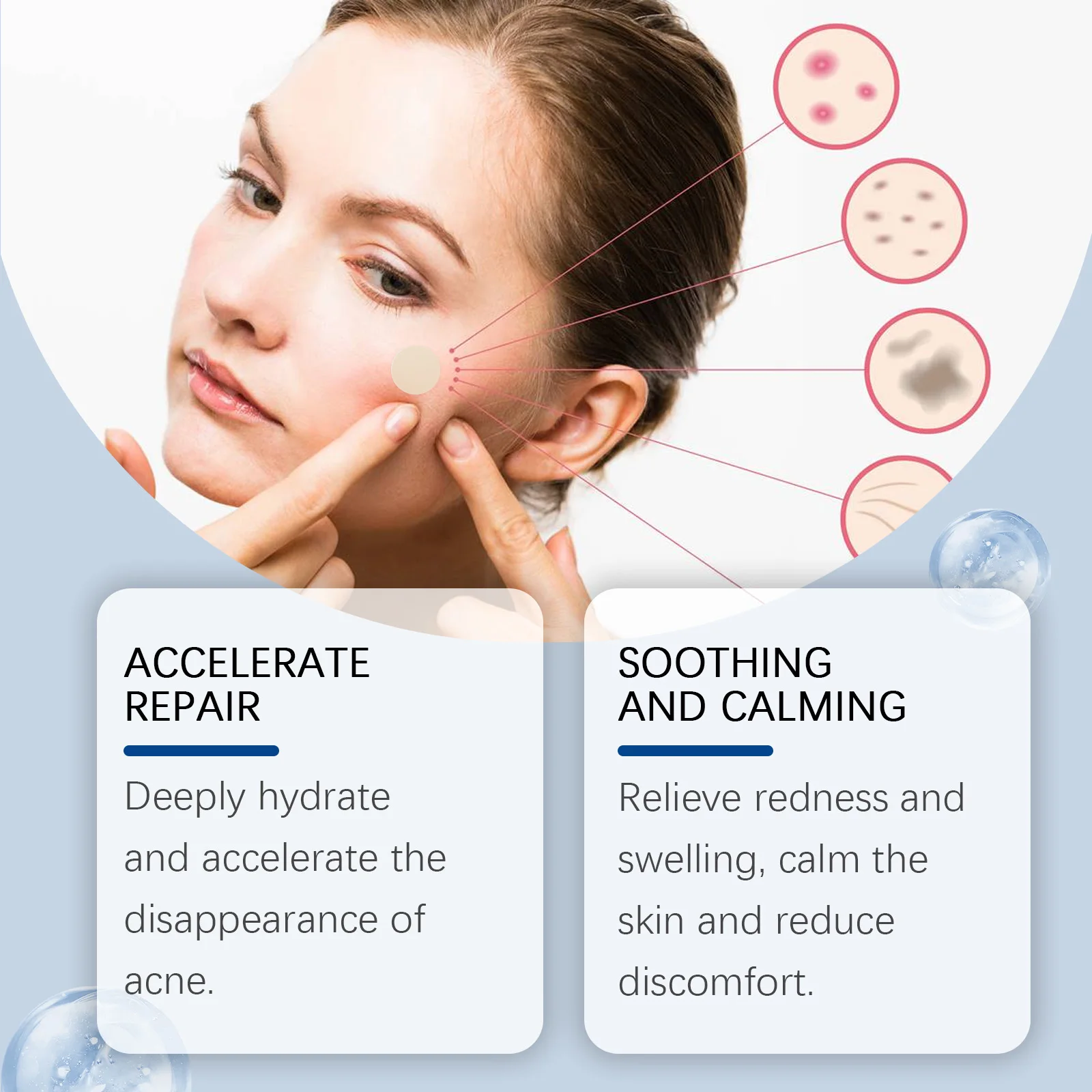 Skin repair acne stickers