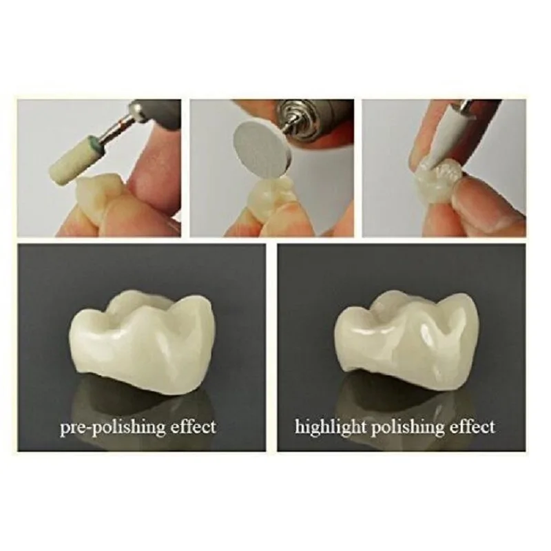 Resina 3d Kit De Pulido Dental Para Higiene Bucal, Kit De Contraángulo Para Pieza De Mano De Baja Velocidad, 1 Juego, RA0309 - AliExprs Limpieza Dental