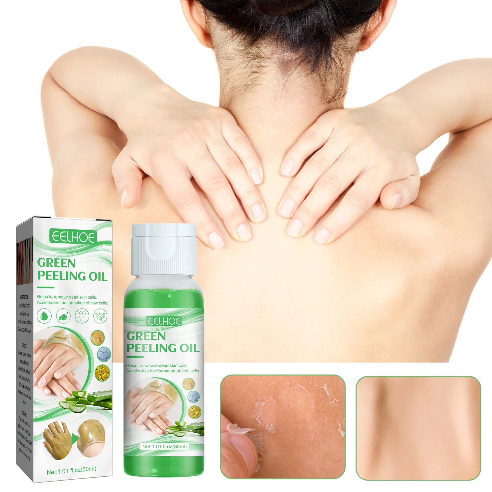 

Green Peeling Oil Bleaching Dark Skin Spots Blackheads Blemishes Bad Skin Spot Treatment Extra Strong Whitening Peeling Oil