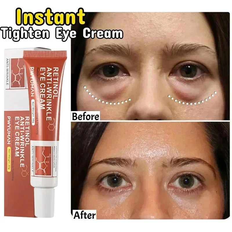 

Instant Eye Bag Remove Eye Cream Anti Fat Particles Dark Circles Puffiness Fade Fine Lines Lift Brighten Korean Beauty Eye Care