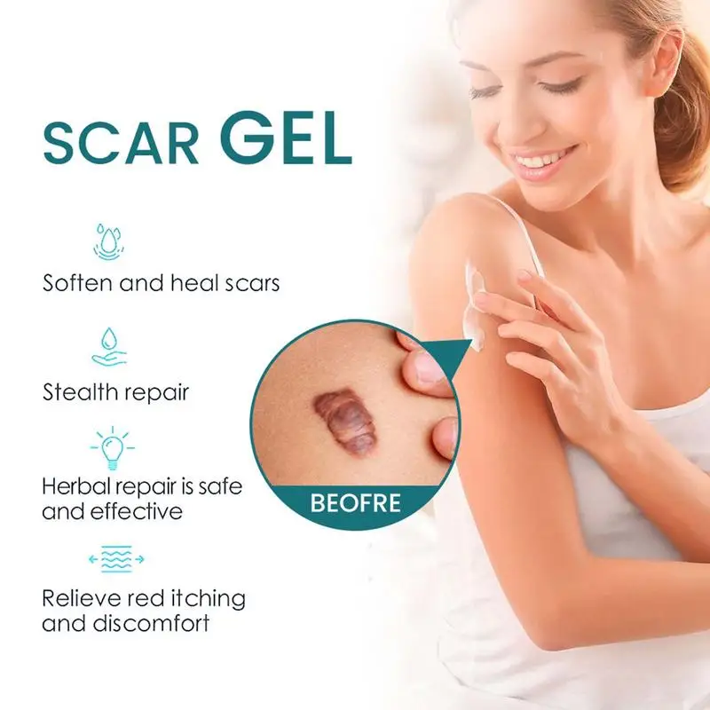 Advanced Scar Gel Soothing Ointment Repair Cream Scar Remover Natural Ointment Cuts Burns Skincare Repair Stretch Mark