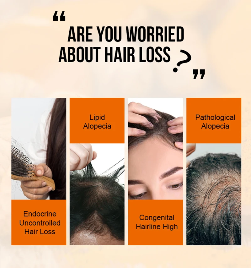 Prodotti per la crescita dei capelli allo zenzero Olio essenziale per capelli a crescita rapida Anti perdita naturale dei capelli Prevenire la cura della riparazione danneggiata crespa secca dei capelli - immagine 5