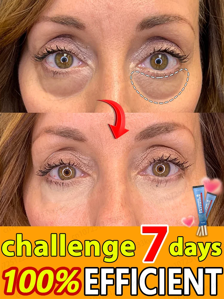 Anti Wrinkle Eye Cream Keep Your Eyes Forever Young anti wrinkle eye cream,eye cream