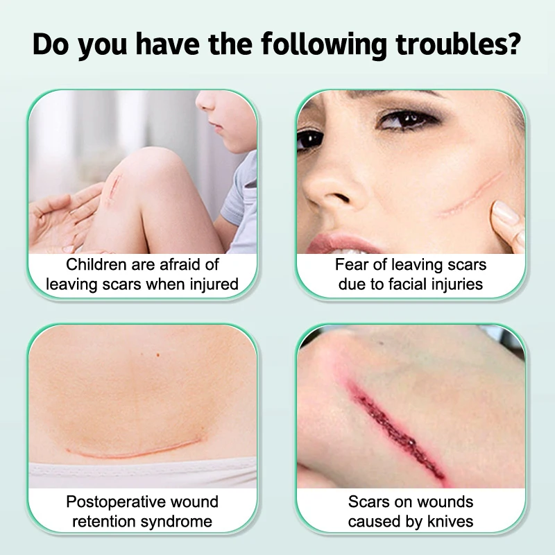 Band-Aid Zipper Tie Wound Closure Patch Hemostatic Patch Wound Fast Suture Zipper Band-Aid Outdoor Portable wound bandage,medical wound dressing,tattoo adhesive bandages