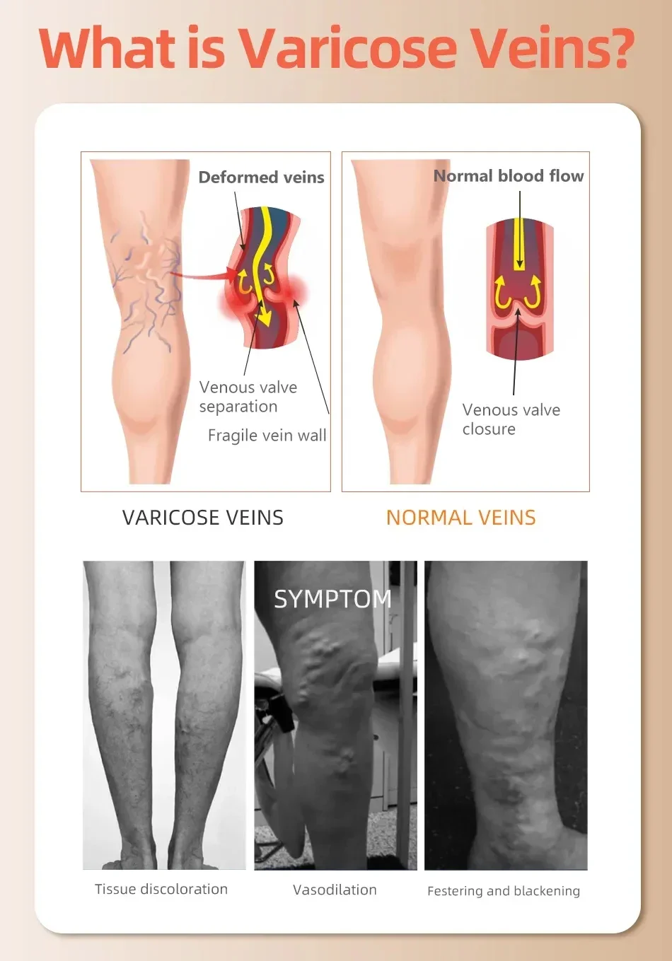 Compression Stockings 5