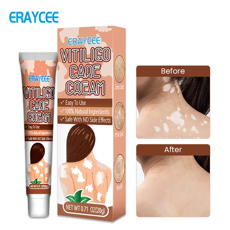 

Eraycee Cross-Border Foreign Trade Temu Joom Amazon Independent Station White Spot Cream Sweat Spot Flower Spot Body Rest Care