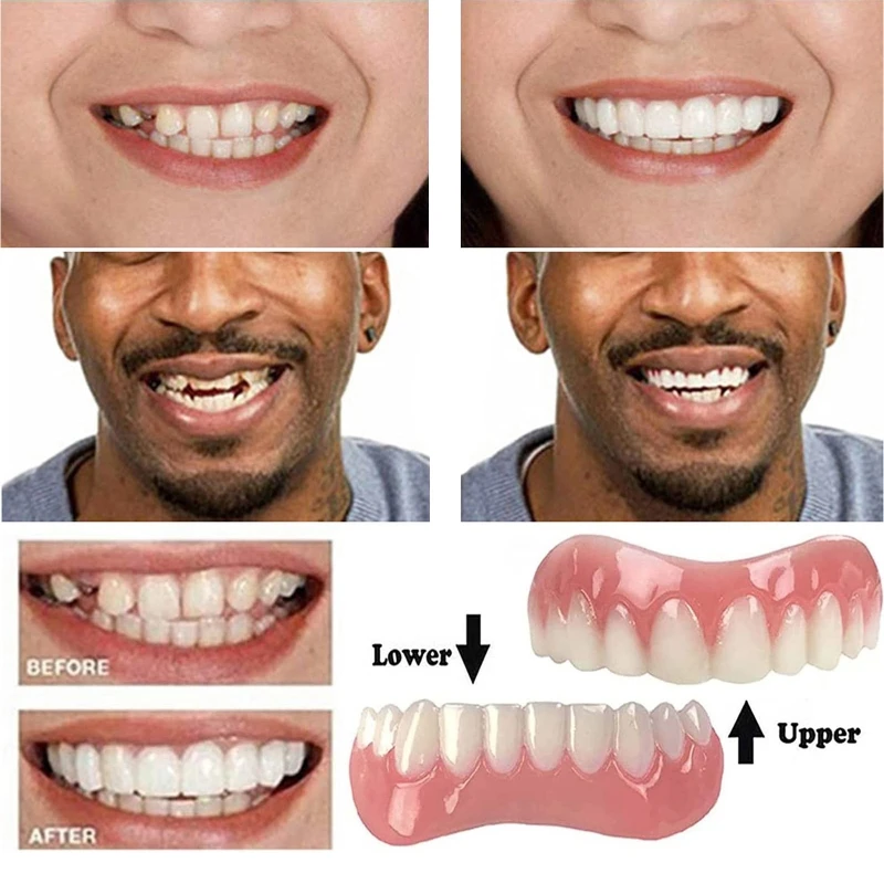 F1FF False Teeth Silicone Upper Lower Veneers Perfect Laugh Veneers