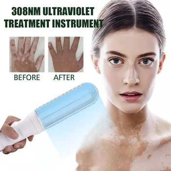 UVB Lamp UV for Vitiligo Psoriasis White Spots Skin Disease311nm Ultraviolet Phototherapy Instrument use