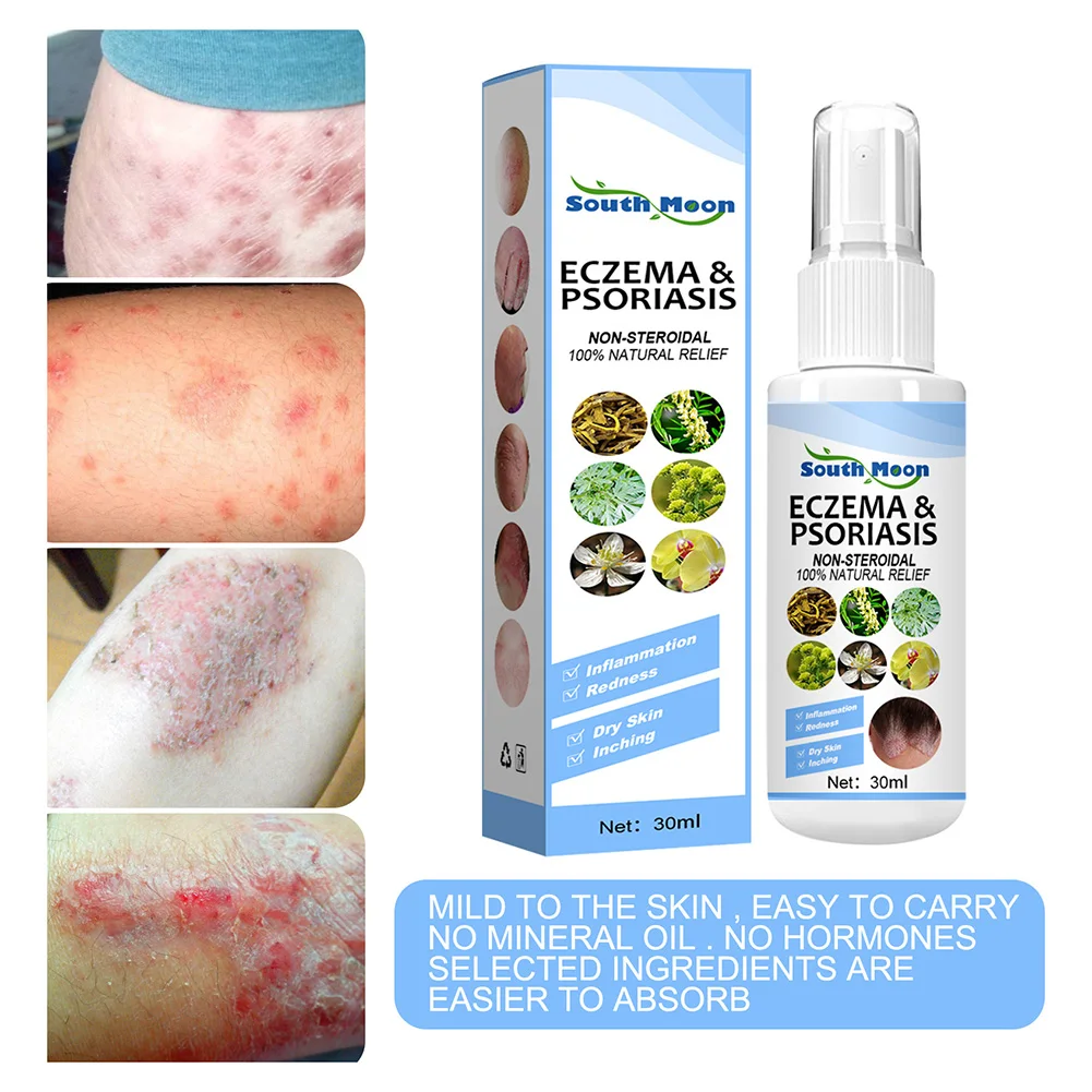 30ml Skin Psoriasis Spray Natural Herb Eczema Treatment Spray Itch Relief Improve Redness Dermatitis Psoriasis Health Care