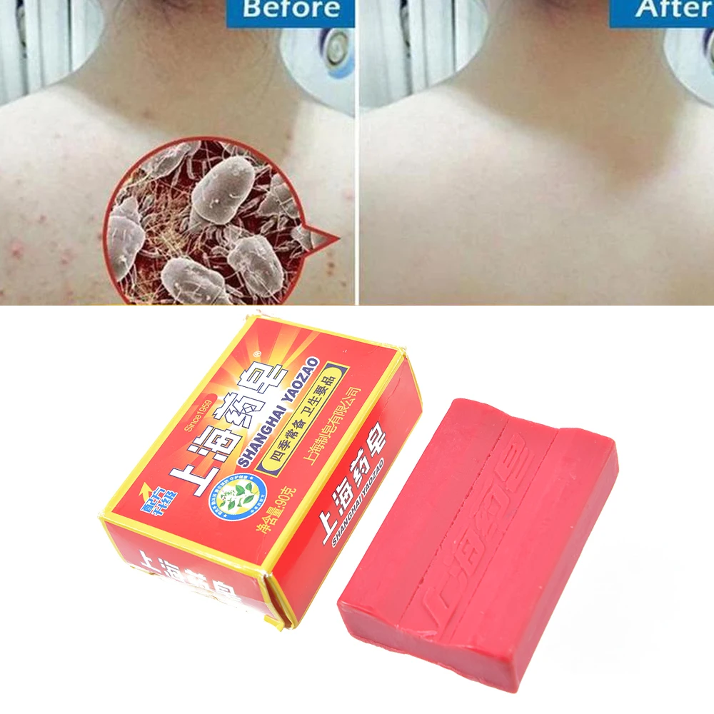 

90g Medicated Soap Conditions Acne Psoriasis Seborrhea Eczema Anti Fungus Bath Healthy Soap Bath Anti-itch Soap