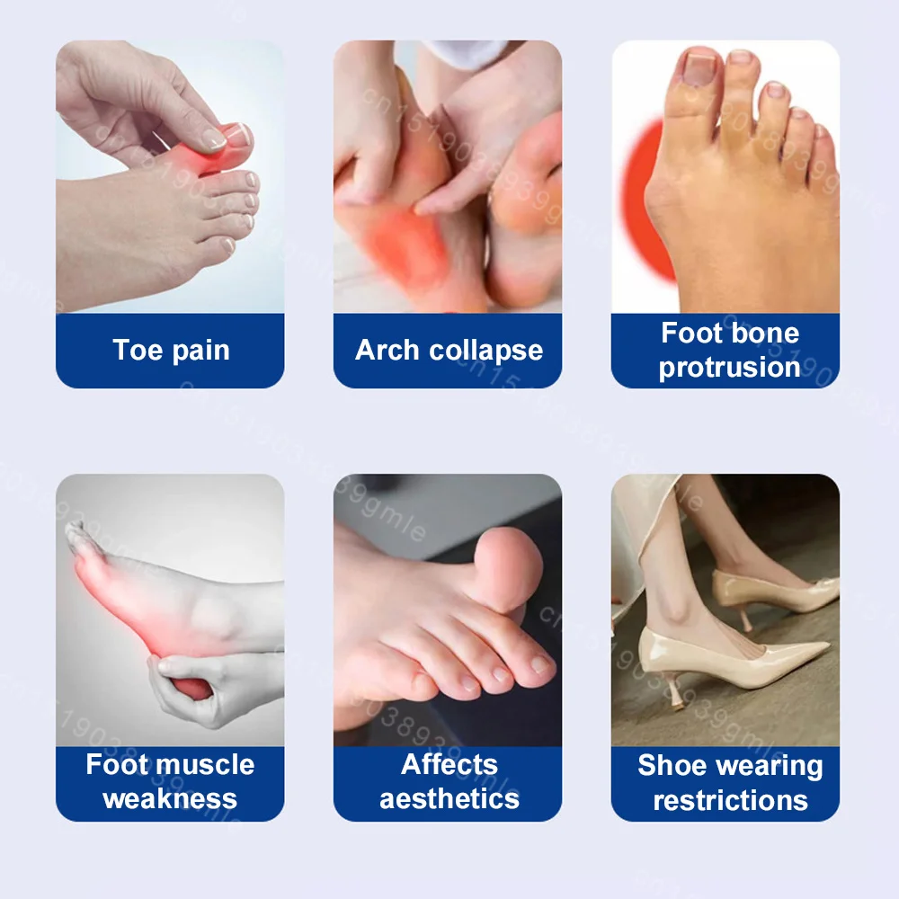 Electric Vibration Massager Bunion Corrector Unisex Foot Hallux Valgus Braces Adjustable Toe Separator Finger Toe Corrector