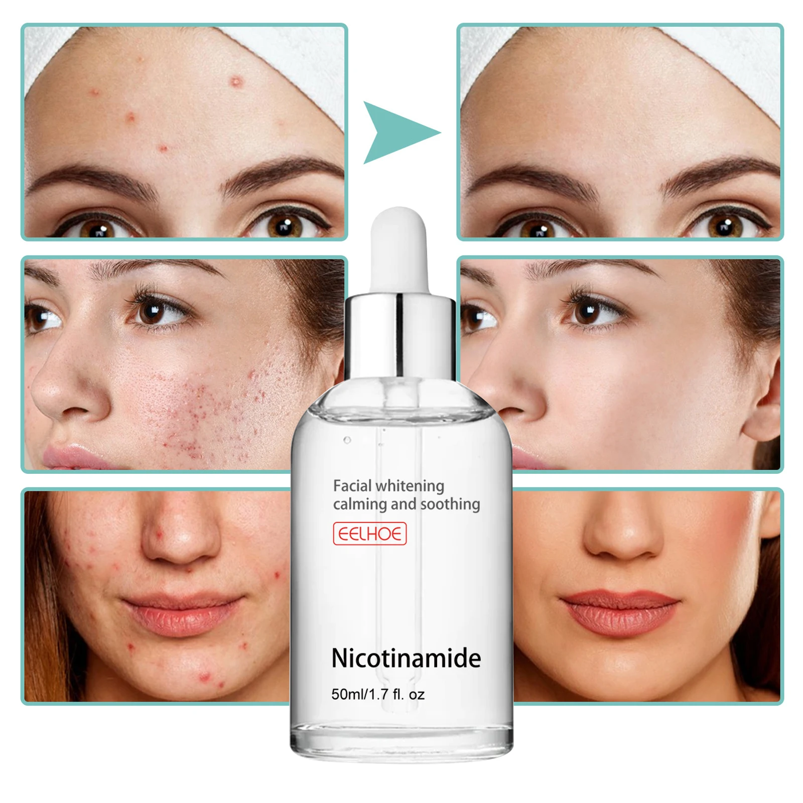 

Acne Treatment Shrink Pores Facial Serum Firm Moisturizing Liquid Repair Face Pores Niacinamide Hyaluronic Acid Whitening Care