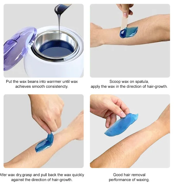 Рисунок 5 - Аппарат для удаления волос