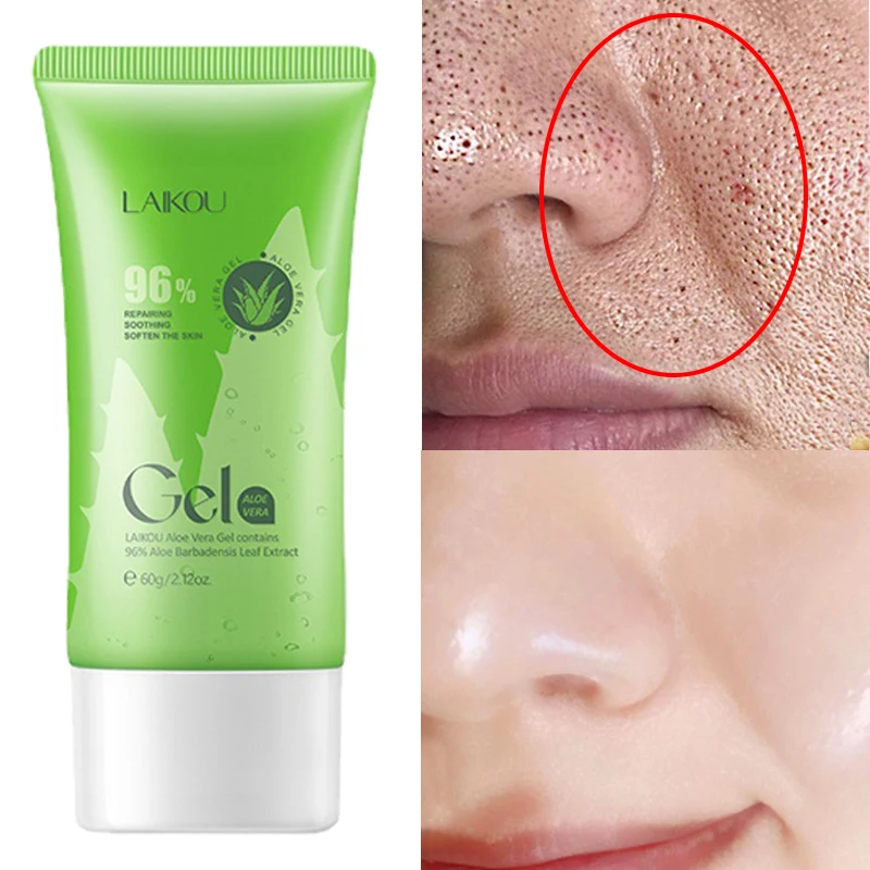 

Exfoliating Aloe Vera Gel Oil Control Face Pore Treatment Serum Whitening For Glowing Pore Shrinking Lighten Fine Lines Care