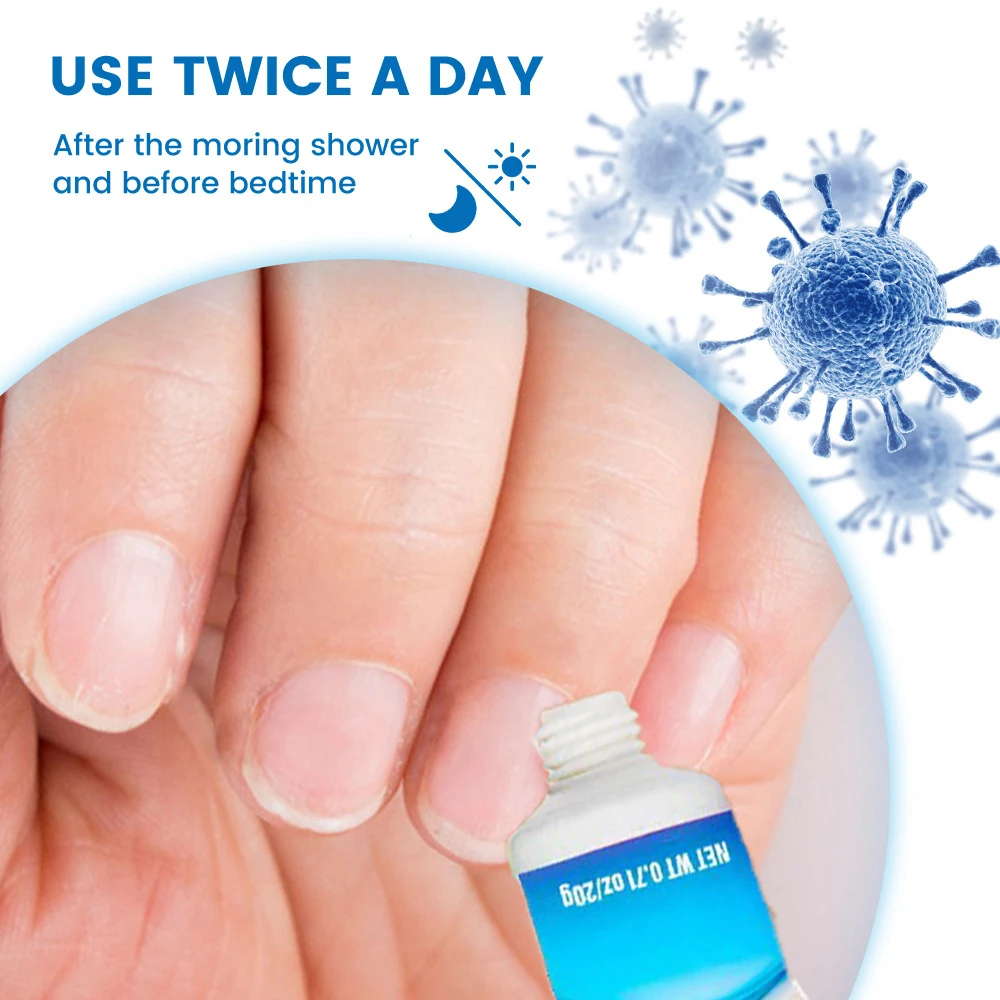 Fungal Nail Treatment Cream Fast Repair Nail Fungus Removal Laser Device Anti Infection Onychomycosis Toenail Fingernail Care