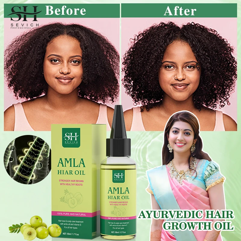 Original Amla Oil For Hair Growth India Gooseberry Hair Oil Anti Hair Loss Scalp Treatment Ayurvedic hair growth oil Sevich textiles of india