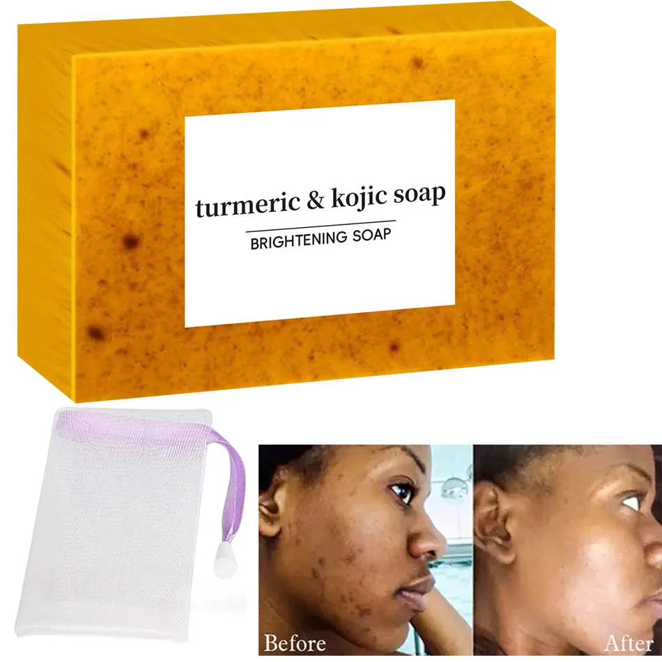 Turmeric Kojic Acid Glow Soap Dark Spot Acne Removal Even Skin Tone Mositen Smooth Skin Deep Cleansing Handmade Soap 1