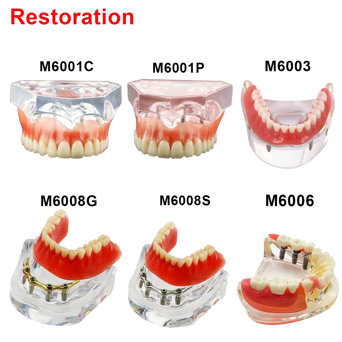 Dental-Model-Teeth-Implant-Restoration-Dental-Prosthesis-Model-For ...
