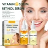 Speciality Freckle Whitening Essence Removal Pigment Melanin Correcting Beauty Face Skin Care Brighten Fade Dark Spot Corrector 1