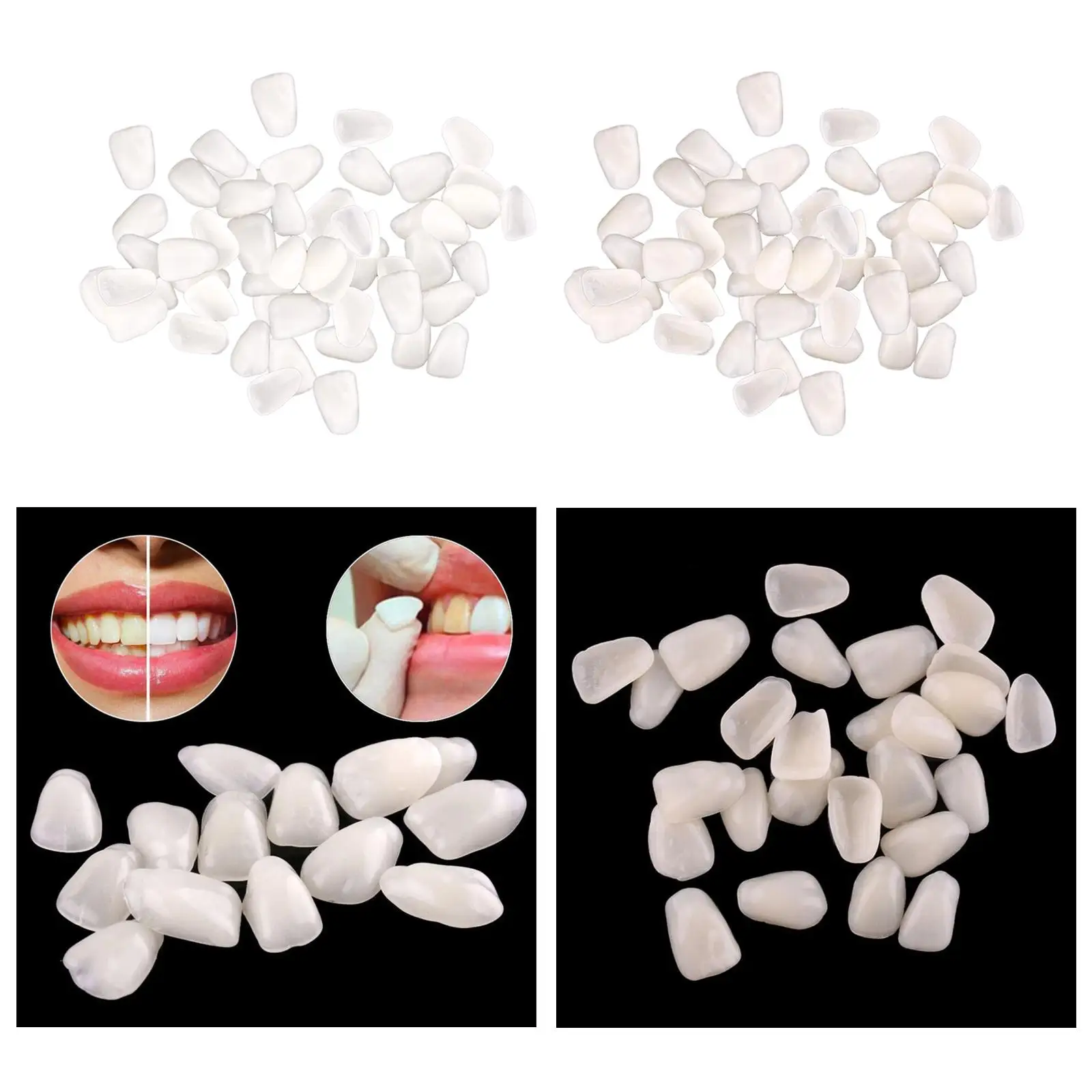 

-Thin Tooth Temporary Veneers Anterior Synthetic Mixed Type