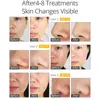 Professional Diamond Microdermabrasion Machine For Facial Peeling Skin Care Blackhead Removel Water Spray Exfoliation Machine 07 6