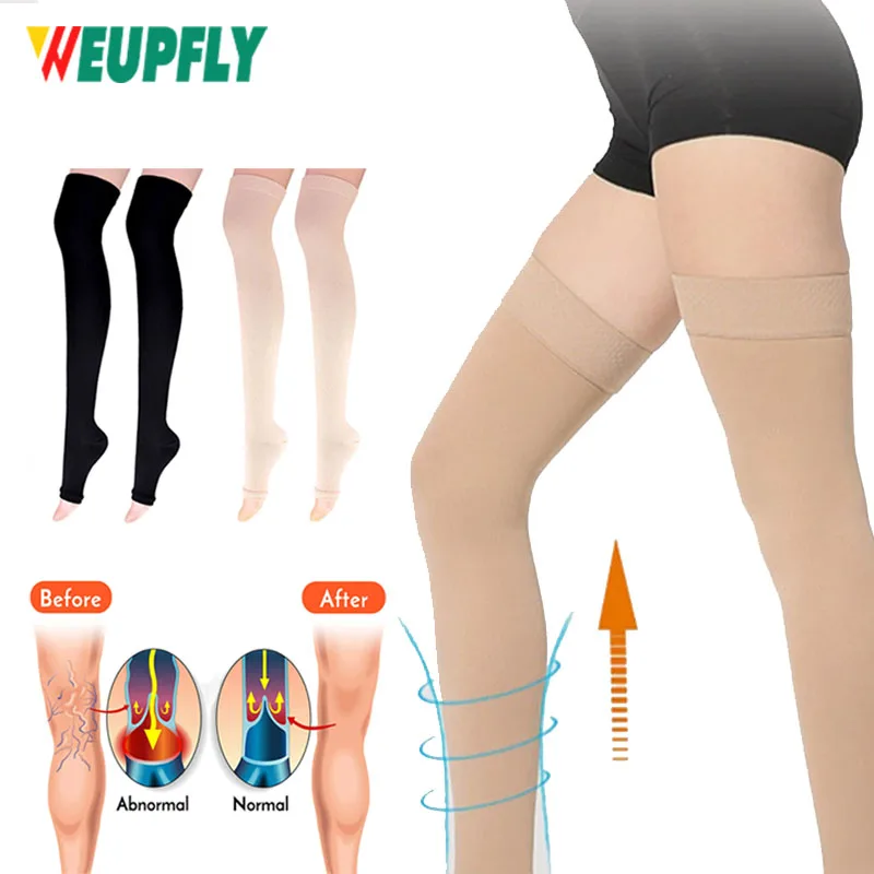 남녀공용 오픈 토 허벅지 고압축 스타킹, 정맥류 정맥, 부종, 비행용 졸업 지지대, 20-30 mmHg, 1 쌍