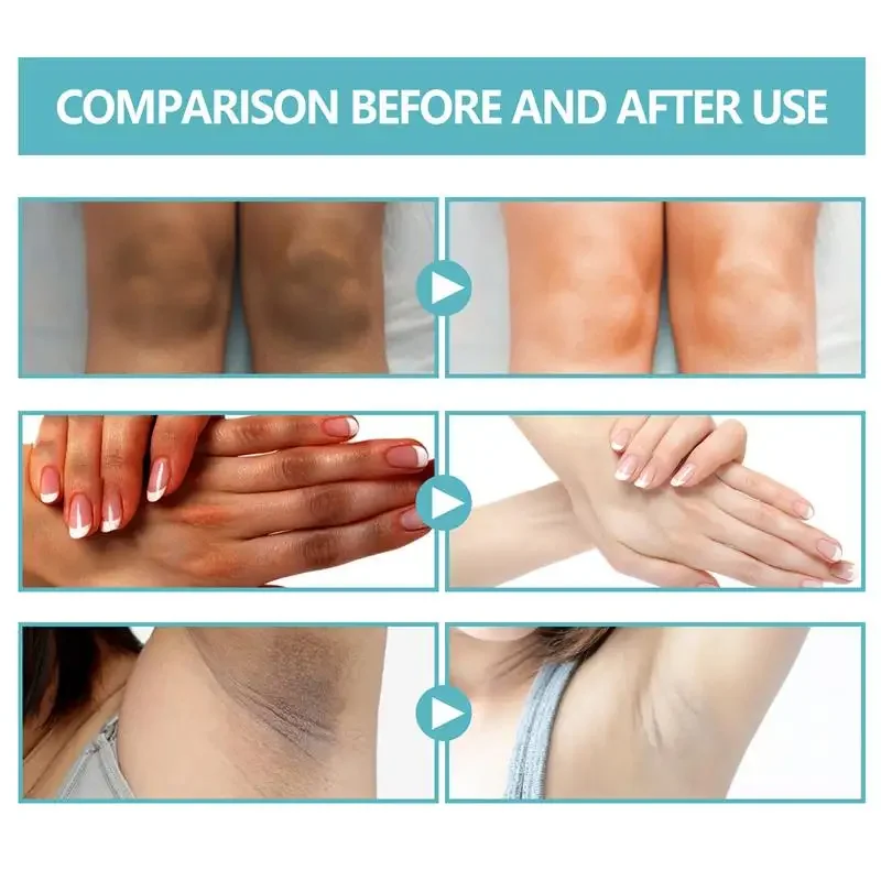 Skin Care Brighten Cream Bleaching Armpits Elbows Knees Moisturizing Body Lotion Cream Brightening Lightening Melanin Skin Cream 6