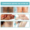 Skin Care Brighten Cream Bleaching Armpits Elbows Knees Moisturizing Body Lotion Cream Brightening Lightening Melanin Skin Cream 6
