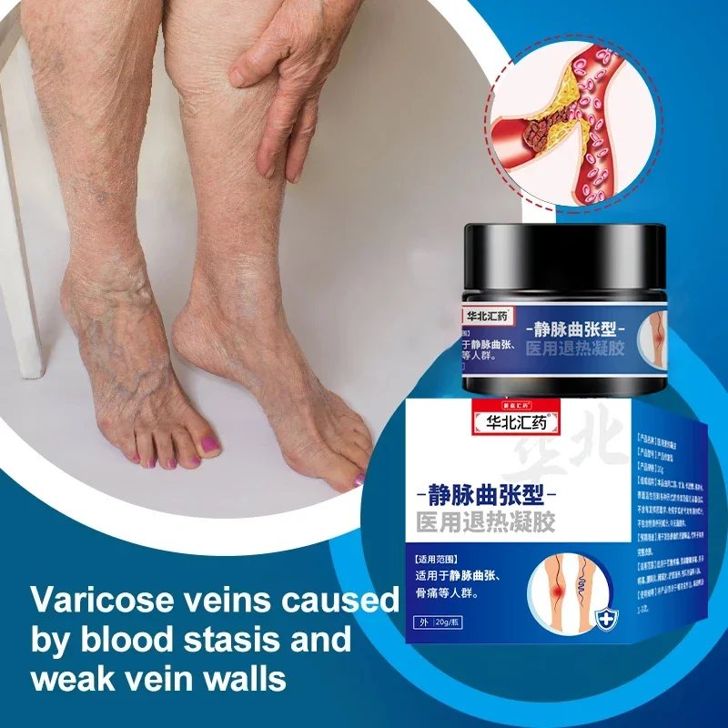 20g Varicose Veins Remover Cream Phlebitis Pain Relief Health Care Varicosity Angiitis Spider Treatments Herbal Medical Plaster