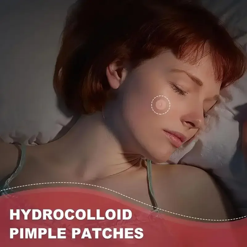 180/360/720 patches/box of hydrogel acne patches can effectively cover acne patches, suitable for both men and women